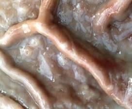 RBUnRCUk (Worms in pig) 2- RBUnRkhmkñúgRkBH (Red stomach worm) manetenaeliemrcuk ehiyvars;enakñúgrkbh nig bwtykqam manrbevg 1 s>m ehiyebleksmlab;rcukgacemil exijmanenakñúgrkbh.