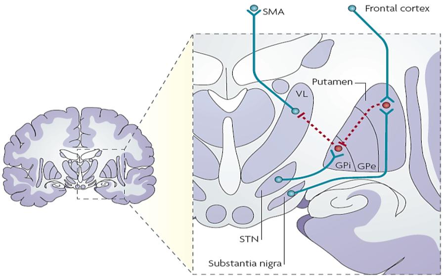 TARGET AREAS OF DBS BASAL GANGLIA DBS for the treatment of movement disorders such as Parkinson s disease, dystonia and tremor has mainly targeted structures in the basal ganglia.