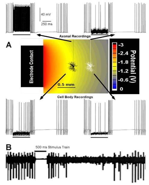 MODELING OF DBS IN NEURONAL LEVEL Effect of DBS on model thalamocortical (TC) relay neurons (see above) A Stimulation: 150 Hz, 0.