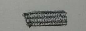 nitinol mely szintetikus polymer polyurethánnal fedett + : Dumon stent migrál + :