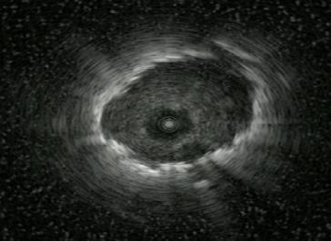 A navigált biopszia választandó Képerősítő Elérhető C-kar drága (+)