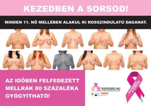 Felhívás emlőszűrésre! Ma Magyarországon a daganatos megbetegedések miatti halálozás a szív és érrendszerit követően a második leggyakoribb halálok.