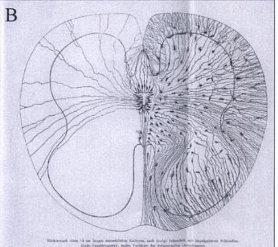 arált anyagban, 1893. A: Supportive 