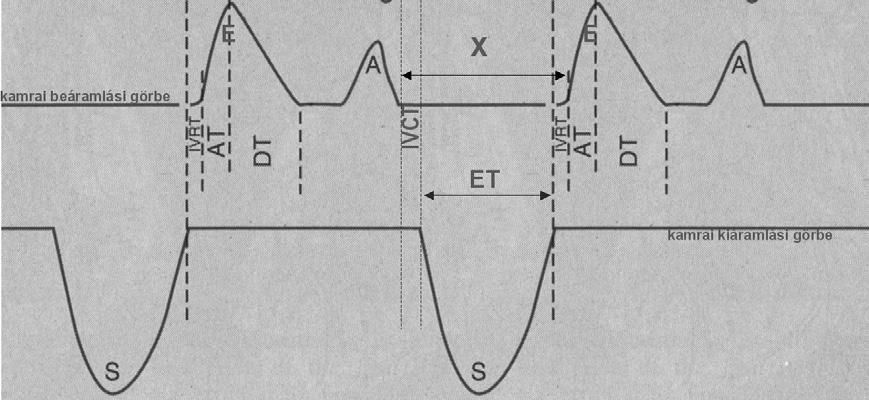 A) A tricuspidalis regurgitatio kimutatása color Dopplerrel, a látható jet III fokú regurgitationak felel meg B) A jobb kamrai nyomás mérése a jet segítségével Szöveti Doppler echocardiographia A