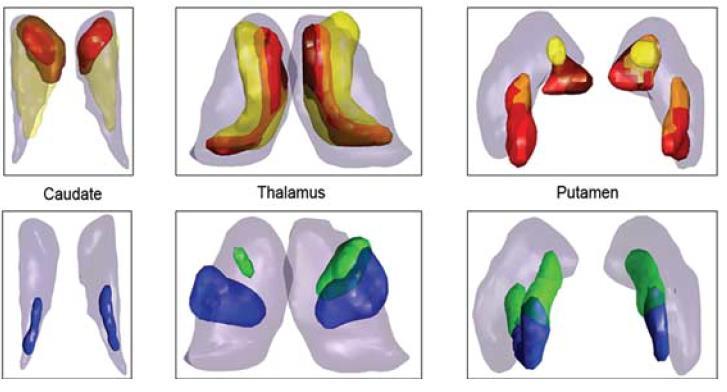Orbitofrontal Cortex OFC Dorsolateral Prefrontal