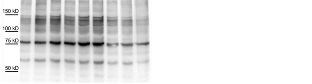 8A. ábra. Akut oxidatív stressz utáni SH-SY5Y neuroblasztóma sejtek O-glikozilációs mintázatának időbeli változása Western-blottal.