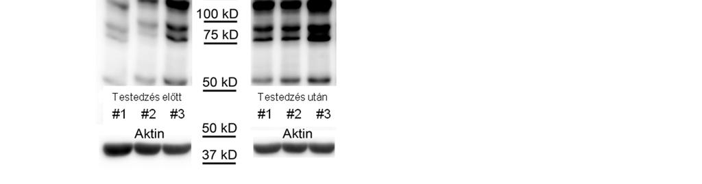 O-glikoziláció vizsgálata Jurkat sejtekben különböző kezeléseket követően Jurkat sejteket az előkísérletben résztvevő önkéntesek testedzés előtti és utáni összegyűjtött humán szérumával,
