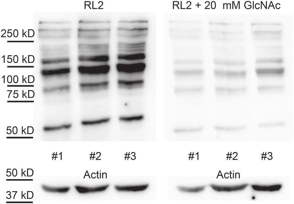 Nagy et al. Exercise Increases Protein O-GlcNAc in Leukocytes FIGURE 3 O-GlcNAc levels elevate in leukocytes following exercise.