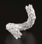 CASE STUDY Achieving conformability and durable results in tortuous anatomy.