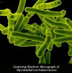 TBC Mycobacterium tuberculosis (MT) Gram-pozitív, lassan szaporodó (6-20 óra osztódás), aerob pálca baktérium MTB rokona az M. Bovis, az M.