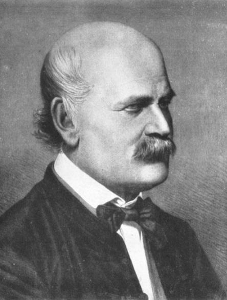 Semmelweis Ignác 1818-1865 Gyermekágyi láz halálozás a Bécsi Egyetem