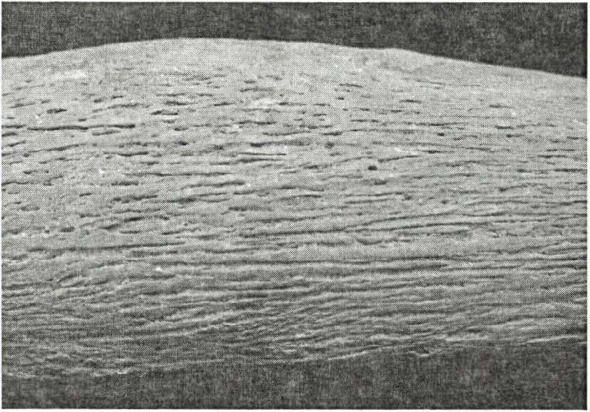 előfordulása nagyban valószínűsíti azok tuberkulózisos eredetét (Pálfi és mtsai 2012). A molekuláris biológiai vizsgálatok során a fogminta (jobb alsó szemfog, 14.