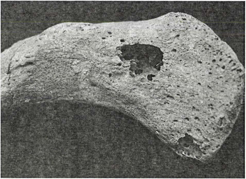 9. ábra: Cysticus lézió a jobb clavicula acromialis végén (6. sír, Mat., nő). Figure 9: Cystic lesion lesion on the acromial end of the right clavicle (Grave no. 6, Mat., female). A 13.