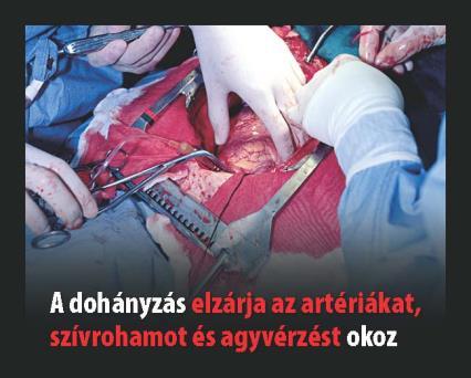 felelősségét is, hogy a nemdohányzó emberek fokozott védelmet, figyelmet kívánnak a másodlagos dohányzás ártalmaival szemben (1999. évi XLII.