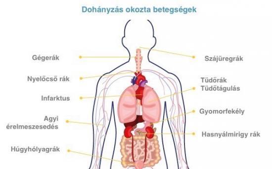 220 halt meg dohányzás következtében, ami az összes halálozás egyhatodát (16%) tette ki (WHO, 2018). A 65 éven aluliak halálozásának 1/3-a Magyarországon a dohányzás következtében alakul ki.