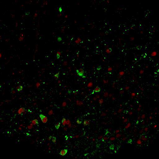 A JD5037 mind a POMC mind az NPY neuronokban javítja a leptin-válaszkészséget POMC + pstat-3 P O M C n e u r