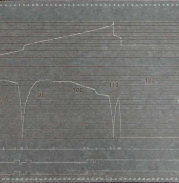4. ábra: a 7504 sz. vonat adatrögzítő szalagja A 7504 sz. vonat és a 45400-1 sz. vonat mozdonyán is üzemelt MFB, amelynek másodperces felbontású adatai a Vb rendelkezésére állnak. 1.