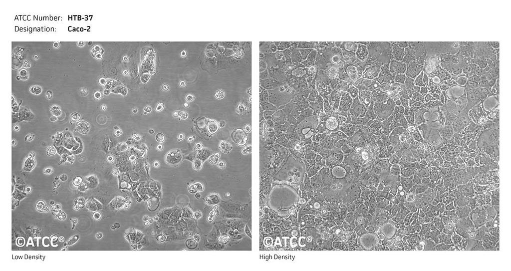 1.2. Caco-2 sejtek A Caco-2 sejtvonalat (4. ábra) humán colon adenocarcinomából izolálták, számos területen alkalmazzák a klinikai kutatásban.