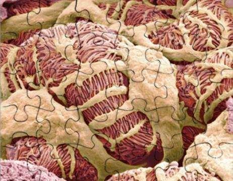 A nefrológiai puzzle elemei egfr aktuális érték, dinamika vizeletmennyiség hematuria proteinuria vizelet ph szérum albuminszint ödéma vérnyomás szisztémás tünetek láz, fogyás, ízületi panaszok,