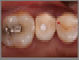 Donos N, Horvath A, Dedi KD, Mezzomo L and
