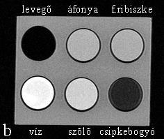 A bárium-szulfát és a Gastrografin a vízhez hasonló módon ábrázolódott. Anyag T1 T2 Víz 12.6 98.2 Zsír 74.6 21.8 Magnevist 101.6 83.4 Teslascan 105.4 17.4 Bárium-szulfát 22.2 90.4 Gastrografin 16.