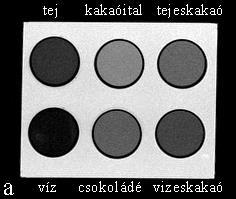 A legnagyobb meglepetést a kakaó okozta, ugyanis mind a T1-, mind pedig a T2-súlyozott felvételen közepes vagy alacsony jelintenzitása volt (4.15.a-b ábrák).