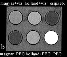 desferrioxamin, csipkeb. - csipkebogyó) a) T1 SE. b) T2 FSE.