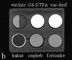 4. fejezet EREDMÉNYEK A T1-súlyozott FMPSPGR méréseken a víz és a kakaó kivételével minden anyag magas jelintenzitással ábrázolódott (4.20.a ábra).