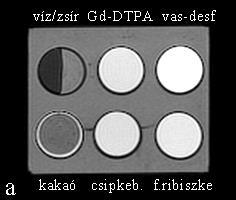 b ábra, 4.7. táblázat). 4.20. ábra A kiválasztott anyagok ábrázolódása T1- és T2*-súlyozott felvételeken. (desf. desferrioxamin, csipkeb. csipkebogyó, f.