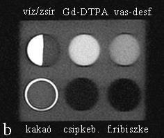 Az IR-Prep FSPGR szekvenciával készült felvételen a kakaó relatíve alacsony jelintenzitású volt és különbözött (CNR > 18) a víz, zsír és Gd-DTPA jelintenzitásaitól (4.22.