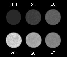 4. fejezet EREDMÉNYEK A pixelenként mért relaxációs idők alapján készültek a T1 és T2 térképek.