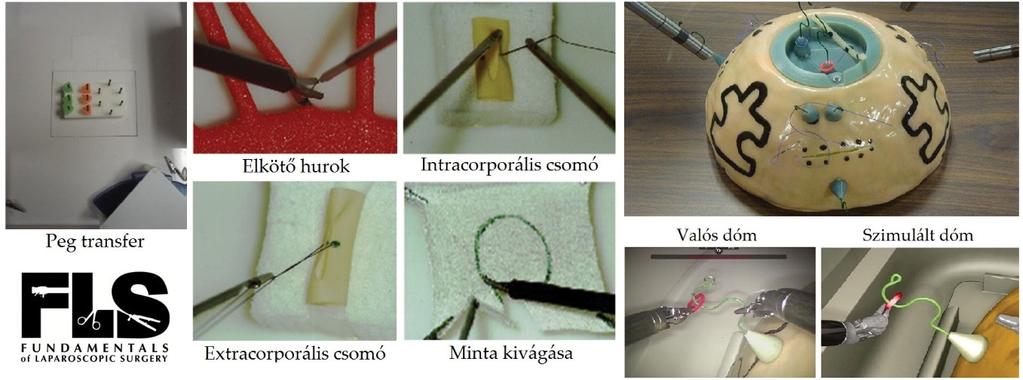 1. ábra Az FLS feladatai és logója (sages.org), illetve az FRS-ben alkalmazott dóm (frsurgery.
