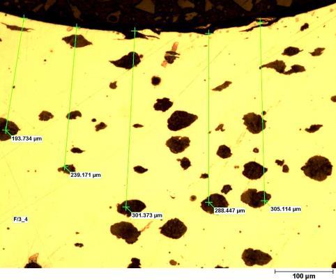 esetében 200 300 µm