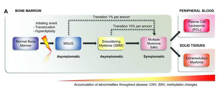 Smouldering myeloma Non-progresszív Progresszív
