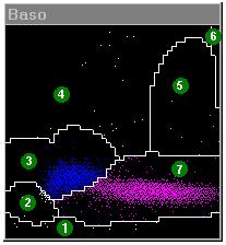 Fehérvérsejtek további tipizálása 2. Felhődiagram a bazofil csatornán 1. Zaj 2. Blasztok sejtmagja 3. Monociták és limfociták sejtmagja 4. Bazofil sejtek 5. Bazofil gyanús sejtek 6.