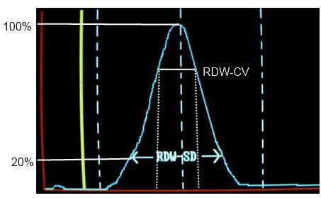 Vörösvérsejt eloszlási szélesség RDW (red cell distribution width) RDW = 100*MCV eloszlás standard deviációja/mcv átlaga vvt-k méretbeli eloszlásának, anizocitózis mértéke Ref: 12-15 % MCV RDW Anémia