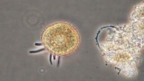 microstoma Zoothamnium spp. Suctoria spp.