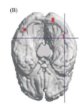 kiszelektálódása ( repetition suppression fmri kísérletekben