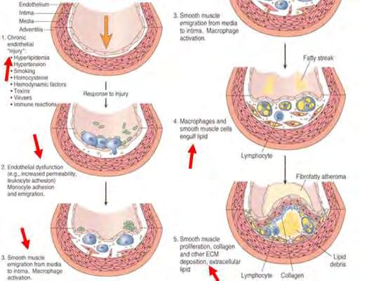 TÁRSBETEGSÉGEK Cardiovascularis Osteoporosis Malignitások