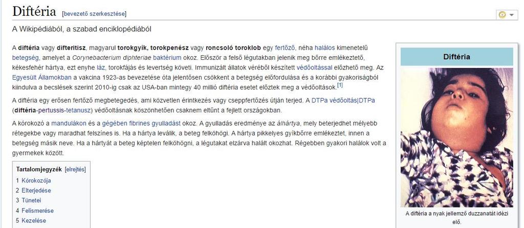 DiPerTe