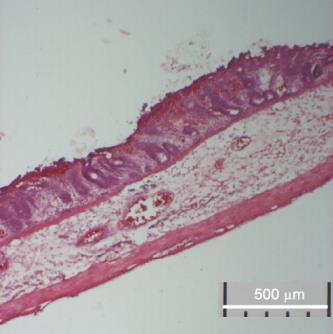 Hematoxilin eozin festés A B A B 35.