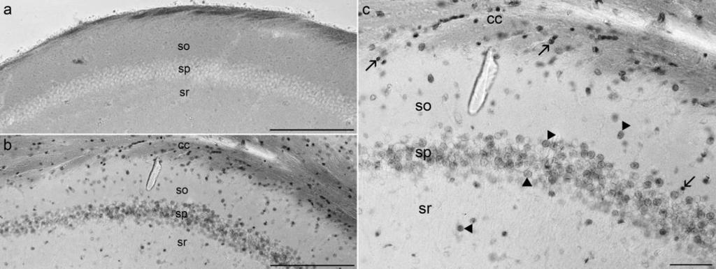 7 Eredmények 7.1 A kinurenin rendszer anatómiai vizsgálata 7.1.1 kat-2 mrns expresszió egér agyszövetben Jelentős kat-2 mrns expressziót detektáltunk az egér agyszövet fehér-, illetve szürkeállományában egyaránt.