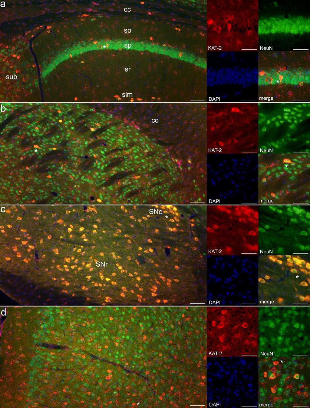 10. ábra: A KAT-2 neuronális lokalizációja egér hippokampusz (a), dorzális striátum (b), substantia nigra (c) és mediális prefrontális kéreg (d) területén. (d). Skála: 80 µm (bal panelek) és 40 µm (jobb panelek).