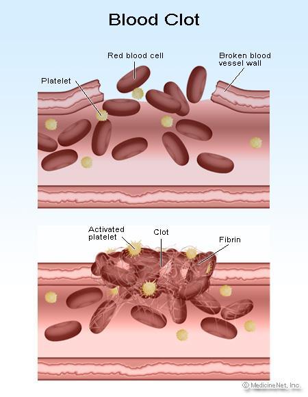imagebank.hematology.
