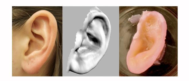 szövetek pótlására, regenerálására. A tissue engineering célja szövetek és szervek előállítása őssejtekből (pl.