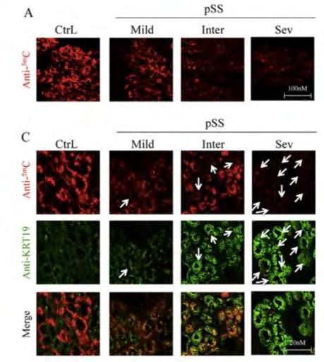 Konsta et al, J Autoimmun 2016;68:30-8. Miceli-Richard et al, Ann Rheum Dis 2016;75:933-40.