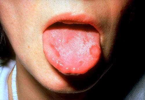 B 2 Vitamin (riboflavin, laktoflavin) thermostabilis flavine mononucleotid (FMN) komponense elektron transzfer Complex I FAD l Complex II.