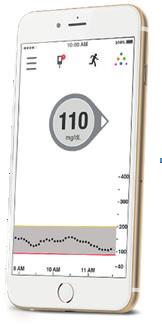 12 Hogyan lehet az Dexcom (G5 mobile/g6