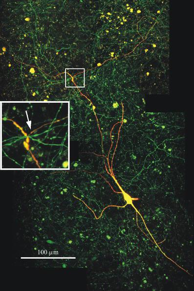 Long systems: Nigrostriatal (A9), mesocortical mesolimbic dopamine projections (A10, A8) Lapisch et al.