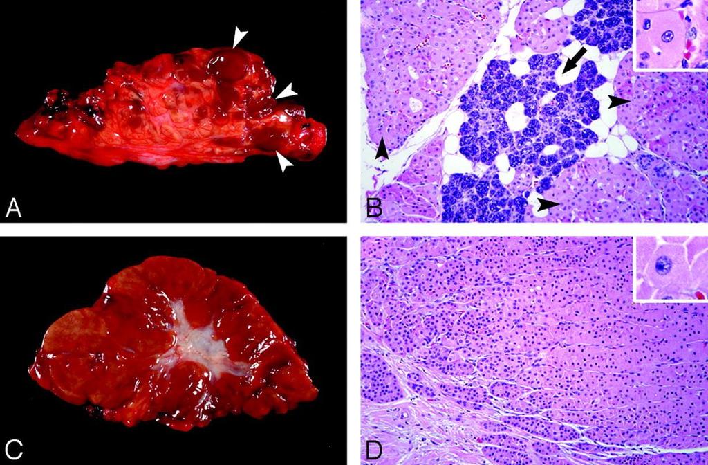 Shellenberger T et al.